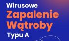 zarys wątroby, tekst: Wirusowe Zapalenie Wątroby Typu A